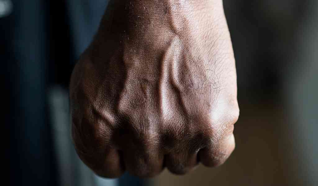 Патологическое опьянение